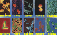 遏制微生物耐药性，从你我做起